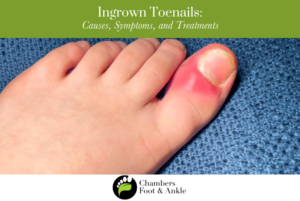 ingrown toenails causes symptoms and treatments