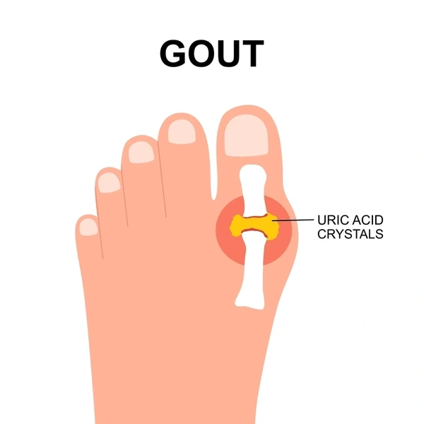 wart treatment in east mesa, az