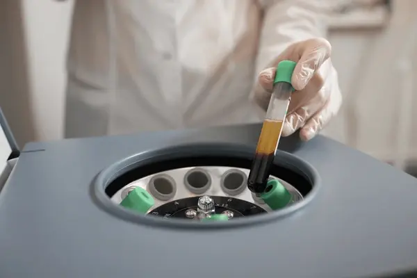 platelet rich plasma therapy in east mesa, az